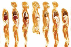 断面标本之切片