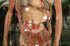 塑化标本之人器官