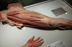 塑化标本之肢体