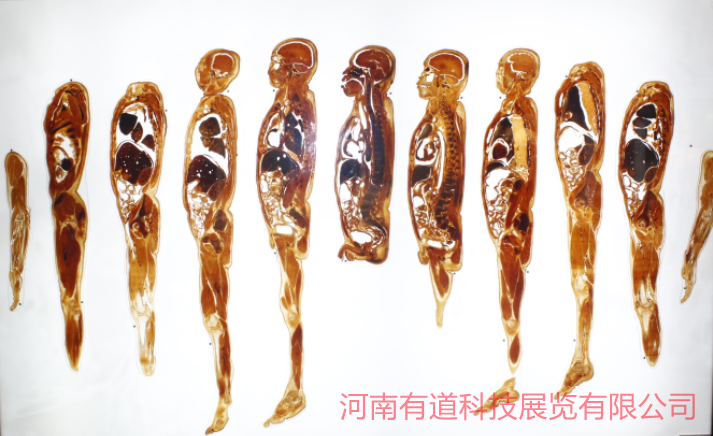 矢状断面包埋